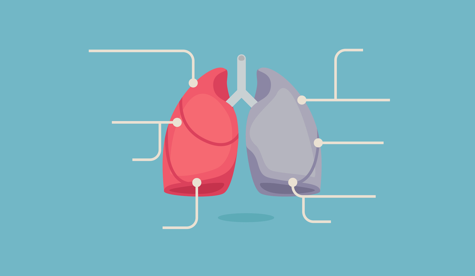 Le cancer est l’une des premières causes de mortalité des le monde. © baluchis, Adobe Stock